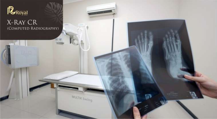 xray <p>Instalasi Radiologi Rumah Sakit Royal Surabaya juga telah dilengkapi dengan alat sinar X-Ray dengan teknologi CR (Computed Radiography). Dengan teknologi CR (Computed Radiography) tersebut, hasil dari foto rontgen yang diambil akan terlihat lebih jelas dan akurat jika dibandingkan dengan sinar X-Ray biasa ditambah dengan kamar gelap yang memadai untuk proses pencetakan foto rontgen tersebut. Sehingga diagnosa yang dapat diambil dari hasil foto rontgen tersebut dapat menjadi lebih akurat dan langkah yang lebih tepat dapat diambil untuk menangani penyakit pasien. Sinar x-ray biasa digunakan untuk rontgen arthritis, pneumonia, tumor tulang, patah tulang, dan lain - lain.</p>